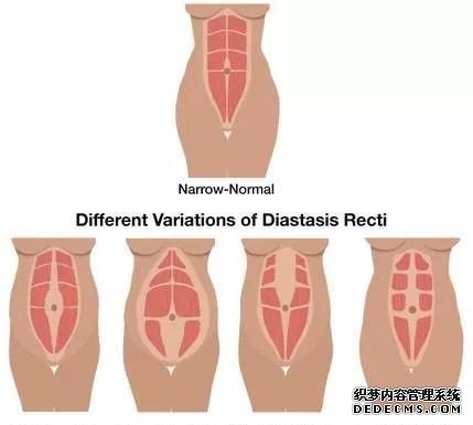 世界互联网大会召开，易适康用AI辅助运动康复仪