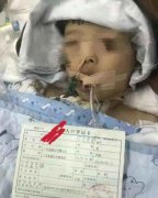 幼儿园5岁男童食物中毒去