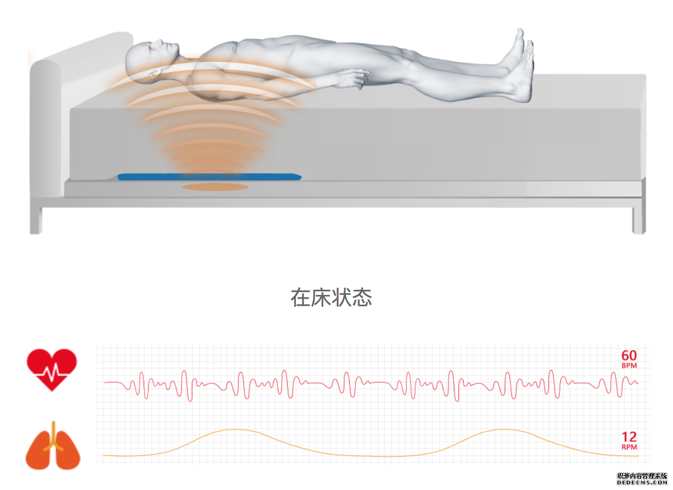 智能床垫呼吸监测助力肺炎早发现