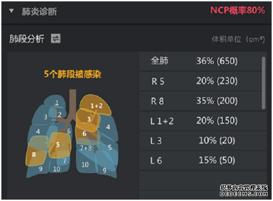 戰“疫”一線引入人工智能技術直擊新冠肺炎分診難題