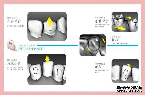 vvsmile联合“智美云医”全国布局51城，共同打造互联网口腔医院