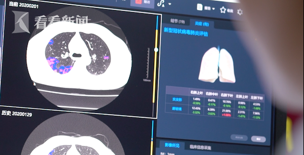 视频｜AI赋能医院抗击疫情 三秒即可识别新冠肺