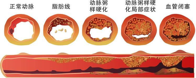 45-55岁，生命中的关键10年，做好4件事，延长寿命并不难