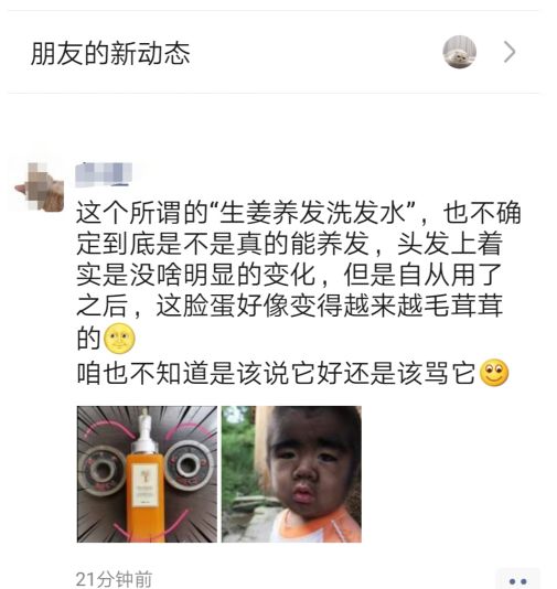 防脱干货，真实经历分享！如何战胜脱发，本文总结多种方法